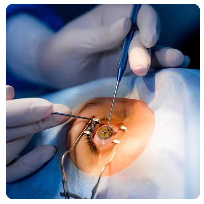 PRK / EPI Lasik doctor in Jalandhar